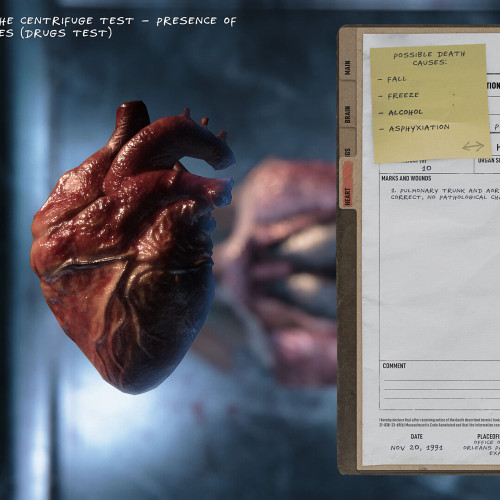 Autopsy Simulator, Steam Gift